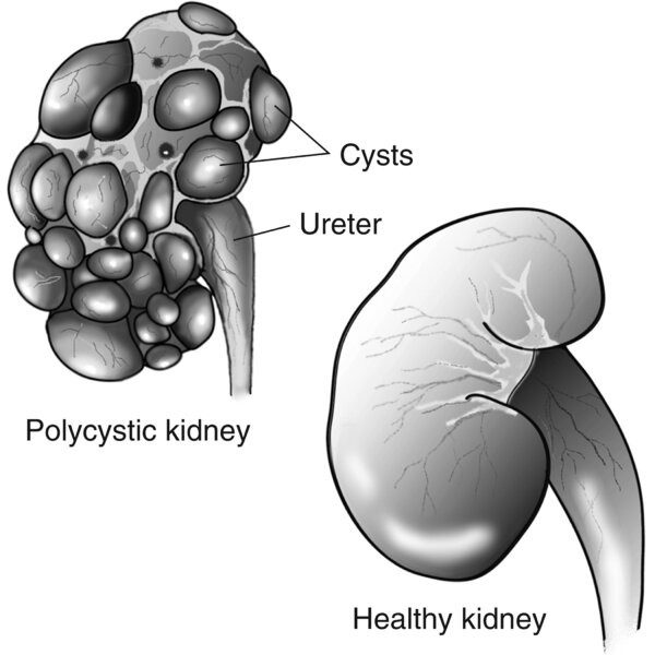 N00687_H_thumbnail.jpg